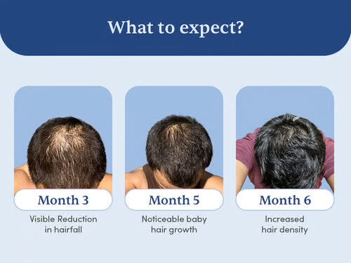 Rabbit Herbal Hair Oil – 100% Stronger, Healthier Growth